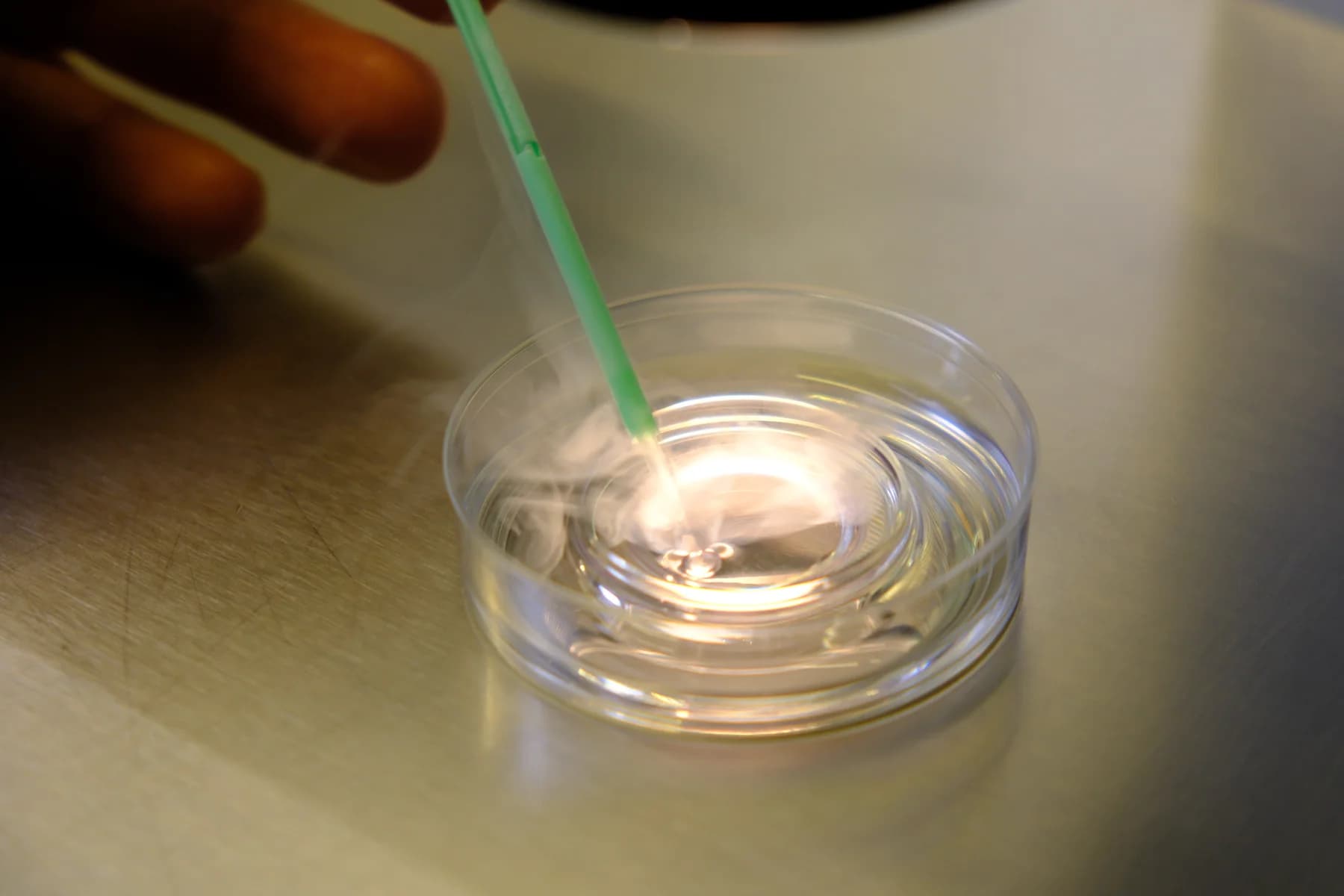 Frozen Embryo Transfer